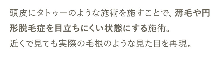 頭皮にタトゥーのような施術を施すことで、薄毛や円形脱毛症を目立ちにくい状態にする施術。近くで見ても実際の毛根のような見た目を再現。