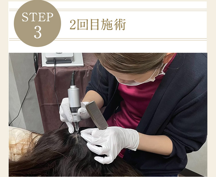 STEP3 2回目施術