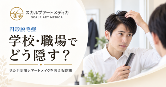 円形脱毛症を治療中、学校や職場でどう隠す？見た目対策と頭皮アートメイクを考える時期