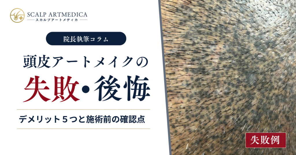 頭皮アートメイクの失敗・後悔｜デメリット5つと施術前の確認点