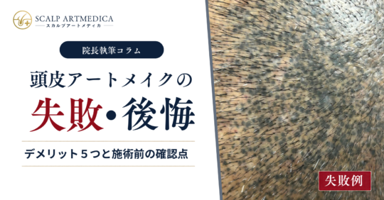 頭皮アートメイクの失敗・後悔｜デメリット5つと施術前の確認点