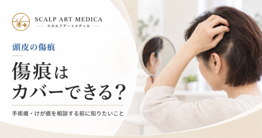 頭皮の傷痕はアートメイクでカバーできる？手術痕・けが痕を相談する前に知りたいこと