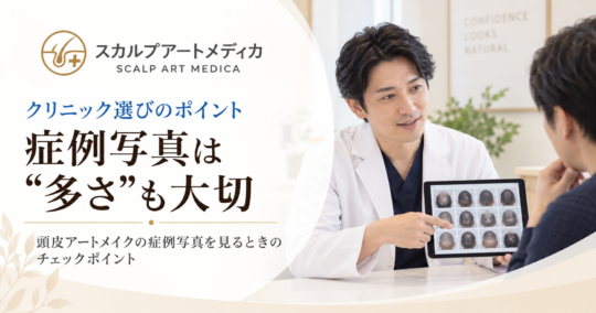 頭皮アートメイクの症例写真は「多さ」も大切｜クリニック選びで見るポイント